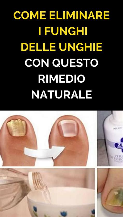 Rimedi Naturali Per Micosi Unghie Piedi Nail Accessories