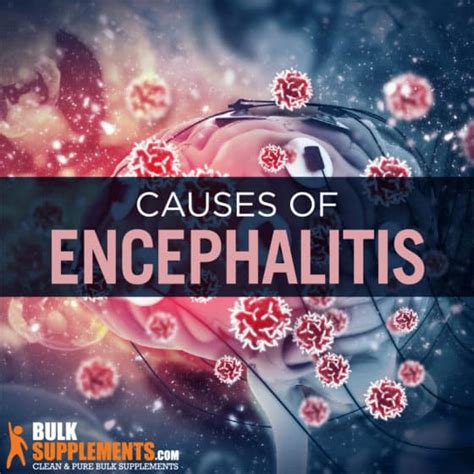 symptoms of encephalitis Archives