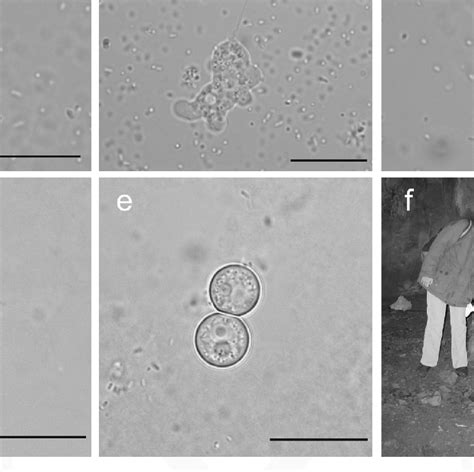 Trophozoites Cysts And Habitat Of Allovahlkampfia Spelaea Trophozoite Download Scientific