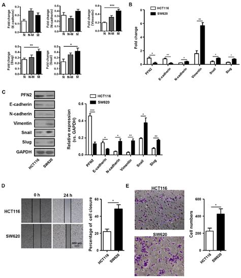 Pfn2 Expression Level Is Associated With Emt Related Molecules And