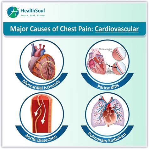 Chest Pain Causes And Treatment Healthsoul