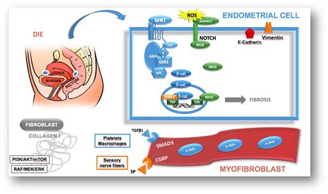 Cellular Components Contributing To Fibrosis In Endometriosis A