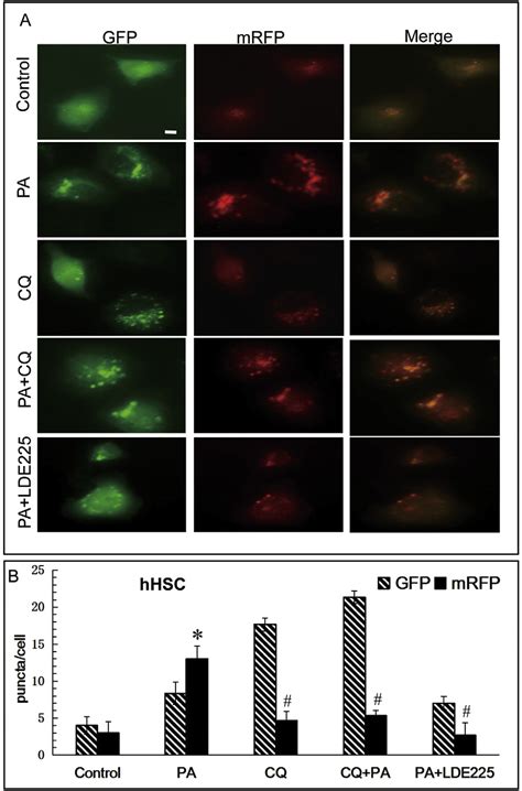 Figure 3 From Palmitic Acid Elicits Hepatic Stellate Cell Activation