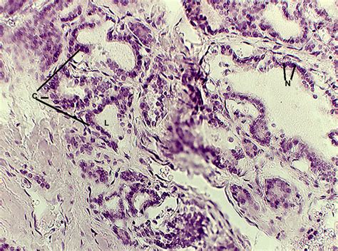 Simple Squamous Epithelium Slide 40x