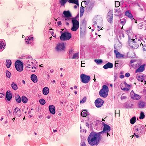 Proposed Life Cycle Of Cyclospora Cayetanensis Modified From Almeria Download Scientific