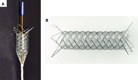 Dual Layer Micromesh Stent Courtesy Of Terumo A And B In Japan