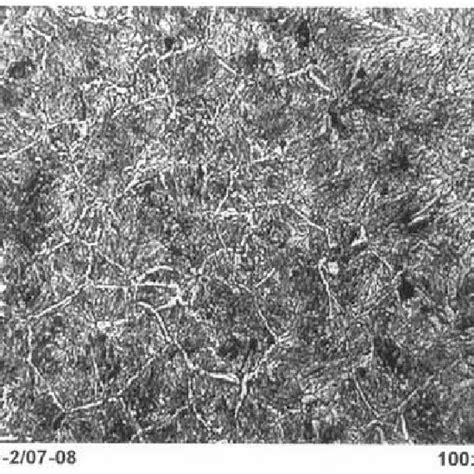 Sem Micro Graph Of Toddy Tapper S Knife From Telangana Showing