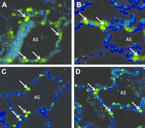 Immuno Fluorescence Images Of Pulmonary Intravascular Macrophages