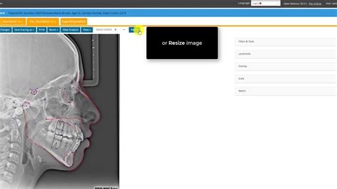 Cephx Editing Cephalometric Tracing Youtube