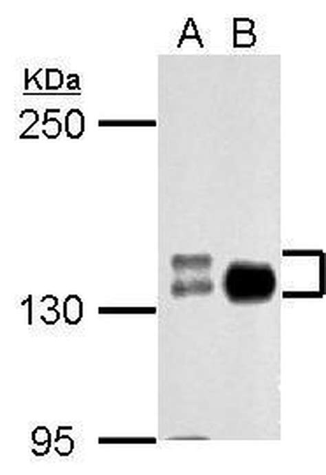 Anti-N-cadherin Antibodies | Invitrogen