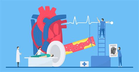 Cardiology Concept With Patient Receiving MRI 965571 Vector Art At Vecteezy