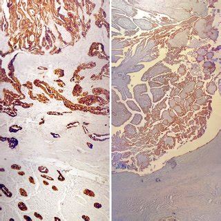 Representative Micrographs Of Ck Immunohistochemical Staining In