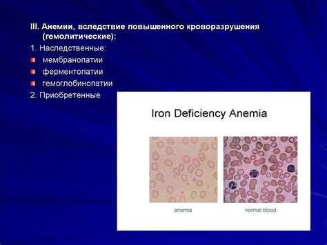 Железодефицитная анемия - презентация онлайн