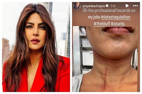 Priyanka Chopra Injured On The The Bluff Set In Australia The Statesman