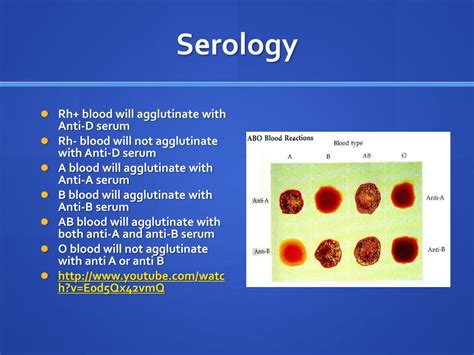 PPT - Forensic Serology PowerPoint Presentation, free download - ID:2526886