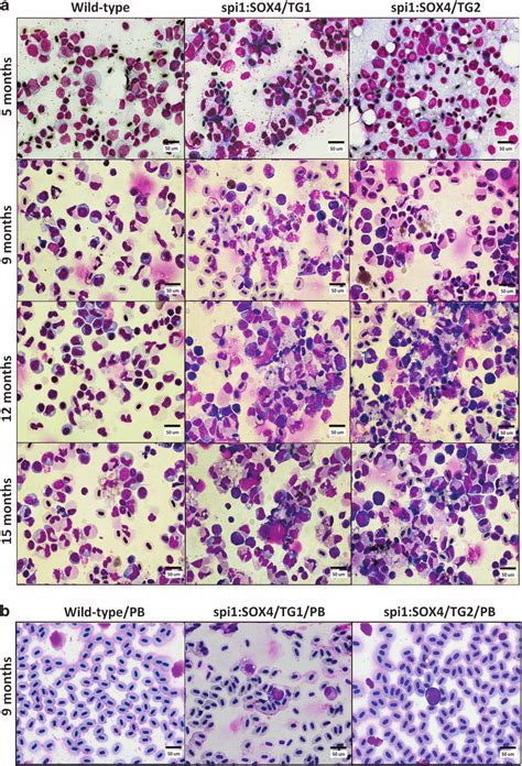 Morphological Analysis Of Various Blood Cell Types Harvested From The