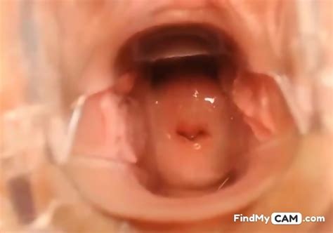 Pussy Close Up And Speculum