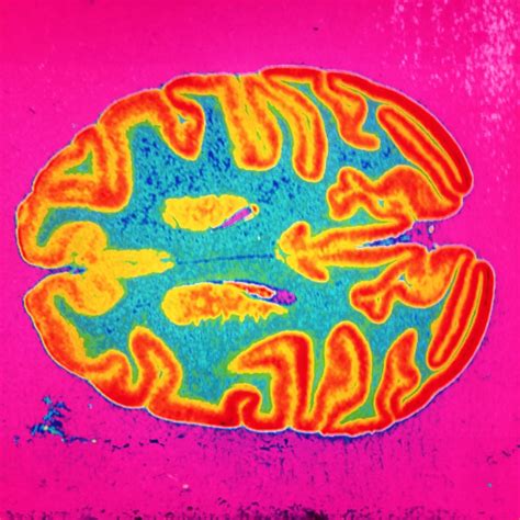 Love To The Brain 9