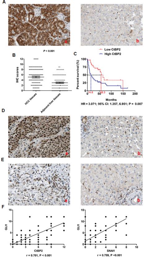 CtBP2 is an independent prognostic marker that promotes GLI1 induced ... 