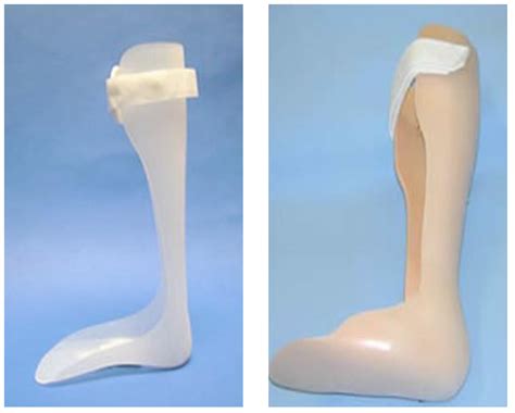 Ankle Foot Orthosis (AFO) - Drwolgin