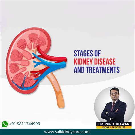 Stages of kidney... - Dr. Puru Dhawan Kidney Specialist
