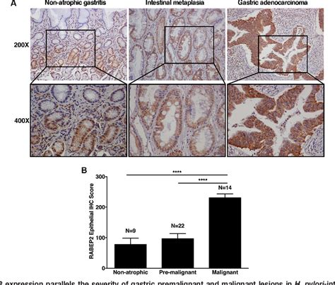 Figure From Carcinogenic Helicobacter Pylori Strains Selectively