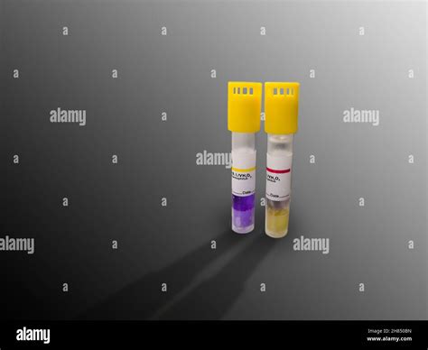 Closeup Image Of Two Positive And Negative Biological Indicators Of ...