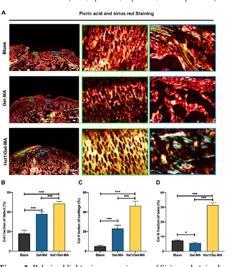 Figure From Hst Gel Ma Scaffold Significantly Promotes The Quality