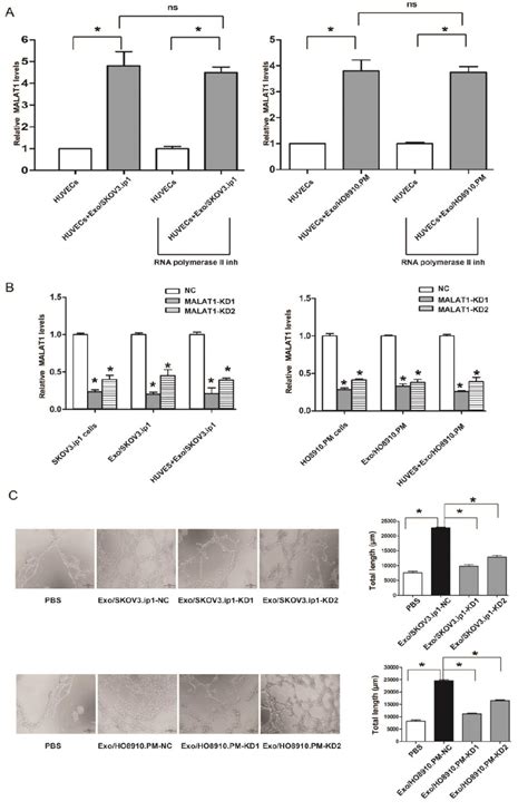 Figure From Exosomal Metastasisassociated Lung Adenocarcinoma