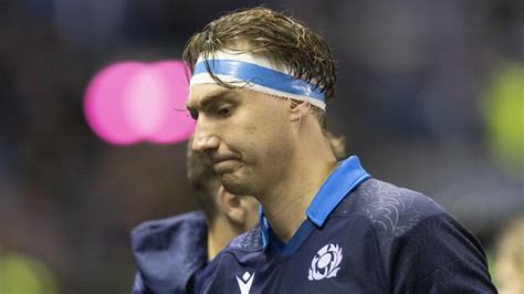 Jamie Ritchie: Scotland showed they can overcome setbacks in loss to ...