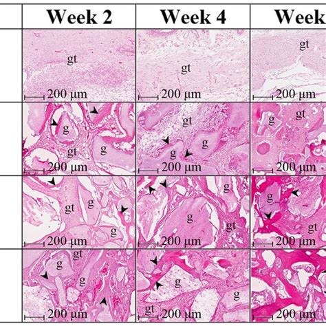 Histology Of Bone Area Tissue Area Of New Bone Formation New Bone Download Scientific Diagram