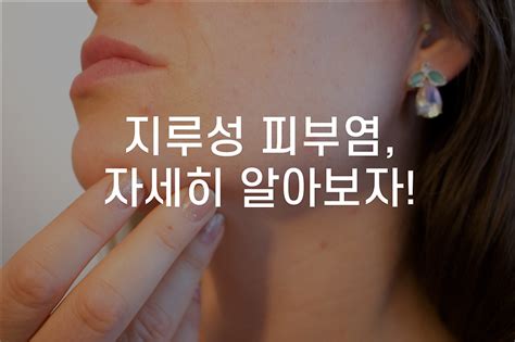 대전지루성피부염한의원 교통사고 야간진료 비대면 진료