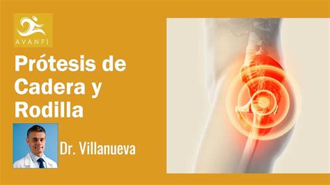 Pr Tesis De Cadera Y Rodilla Por El Especialista En Casos Complejos Dr