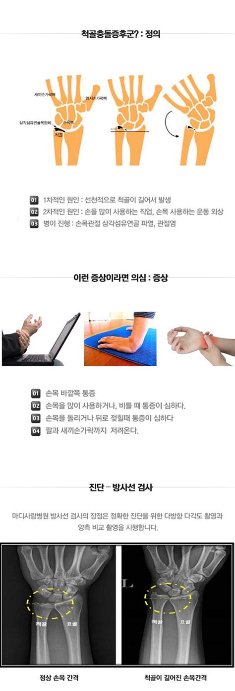 마디사랑병원 질환별 소개 손목 척골충돌증후군