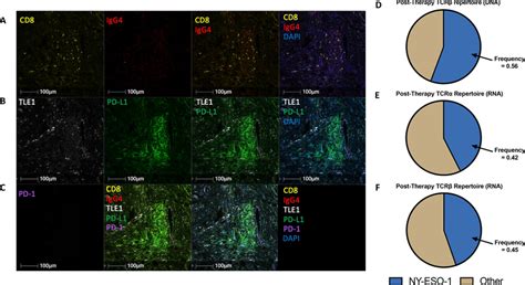 Nivolumab And Ny Eso Transgenic Tcr Track To The Site Of The Tumor