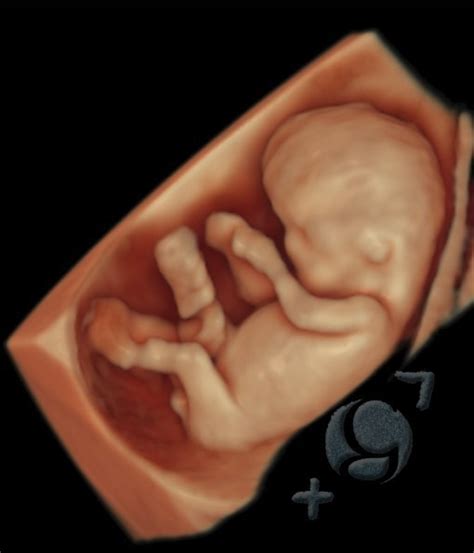 Ecografia 4d Y Medicina Fetal Centro Gutenberg Eco 4d Para El Embarazo