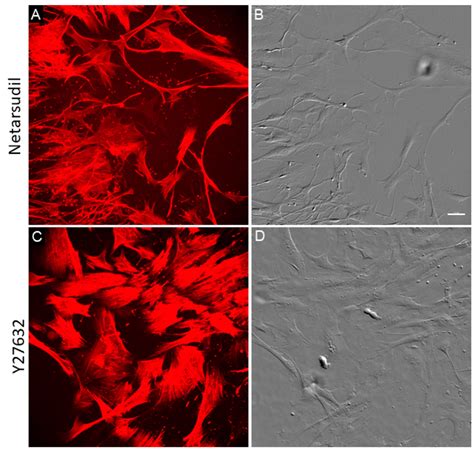 Prolonged Effects Of Netarsudil On Glaucomatous Tm Cells Gtm Cells