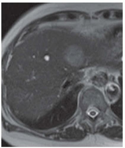 C3-FF53.gif | Abdominal Key 