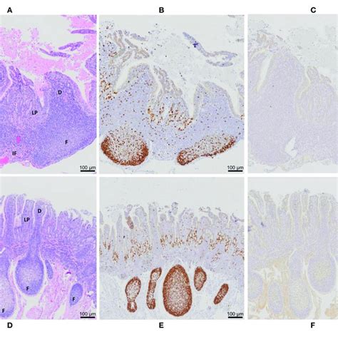 Peyer S Patch Architecture And Histochemical Staining Of Intestinal