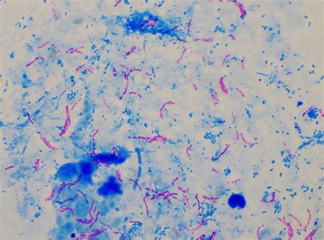 Mycobacterium Smegmatis Acid Fast Stain