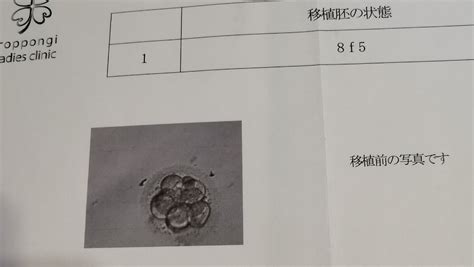 【不妊治療振り返り】移植前検査と移植①回目 42歳からの妊活 45歳11ヶ月でママに