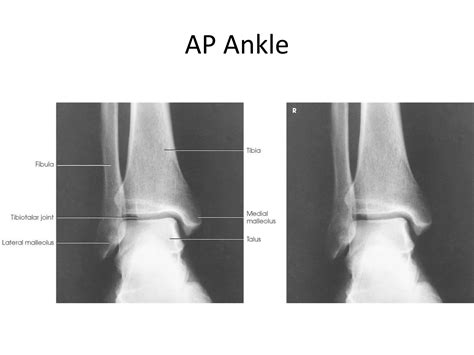 All Projections Anatomy Ppt Free Download