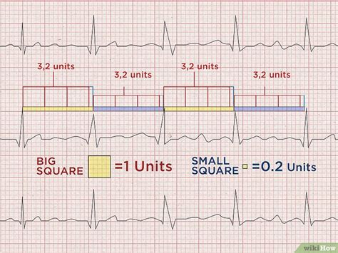 Cómo Calcular La Frecuencia Cardiaca A Partir De Un Ecg