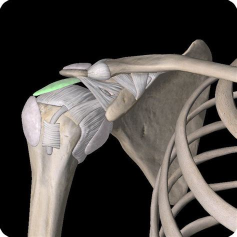 Subacromial Bursitis