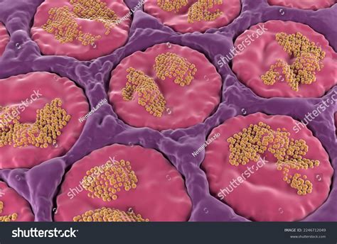 21 Tumors Jaws 3d Images Stock Photos Vectors Shutterstock