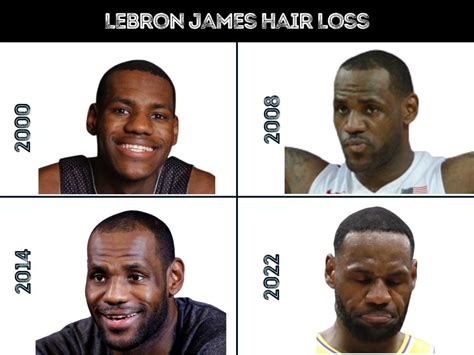 Lebron Hairline Timeline 2022