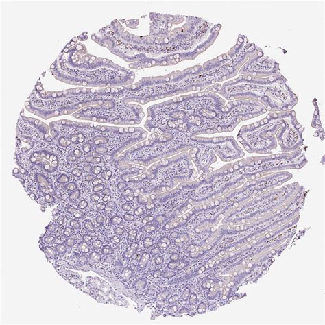 Tissue Expression Of Cd68 Staining In Duodenum The Human Protein Atlas