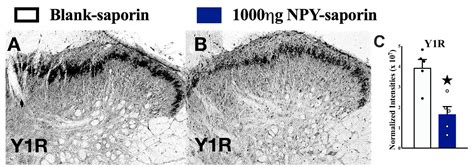 Elimination Of NPYR Neurons With NPY Saporin A Review Of The