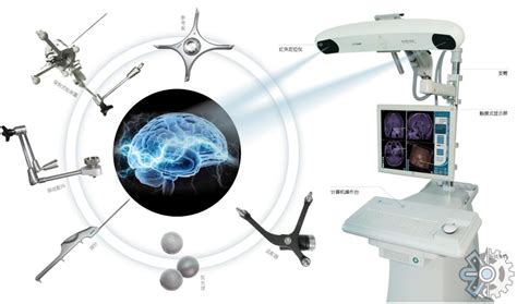 手术导航系统行业数据：2021年全球手术导航系统收入大约1188百万美元财富号东方财富网