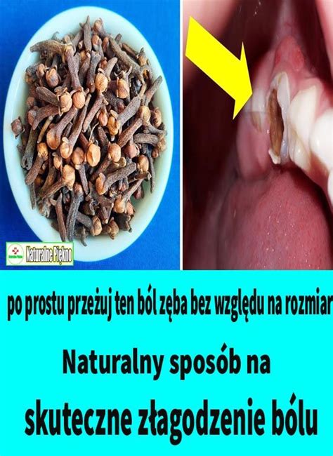 Domowe Rodki Na B L Z Ba Naturalny Spos B Na Skuteczne Z Agodzenie